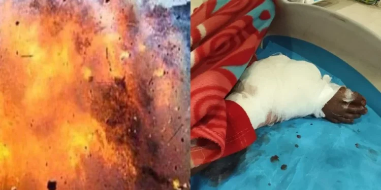 बीजापुर में नक्सलियों के लगाए IED की चपेट में आया नाबालिग, गंभीर रूप से घायल मवेशी चराने गया था जंगल, पैर और चेहरे पर आई गंभीर चोटें
