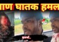 जमीन विवाद में लाइफ केयर पैथोलॉजी के मालिक अजय कुमार पटेल पर ताबड़तोड़ हमला, गंभीर रूप से घायल