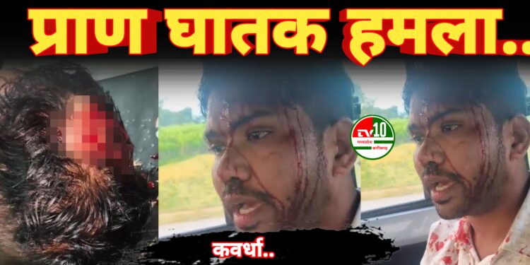 जमीन विवाद में लाइफ केयर पैथोलॉजी के मालिक अजय कुमार पटेल पर ताबड़तोड़ हमला, गंभीर रूप से घायल